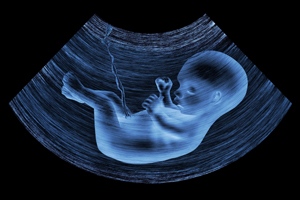 胎盘早剥对胎儿的影响有哪些